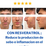 Crema Antiedad Mens para Hombres | Revitaliza e Hidrata tu Piel
